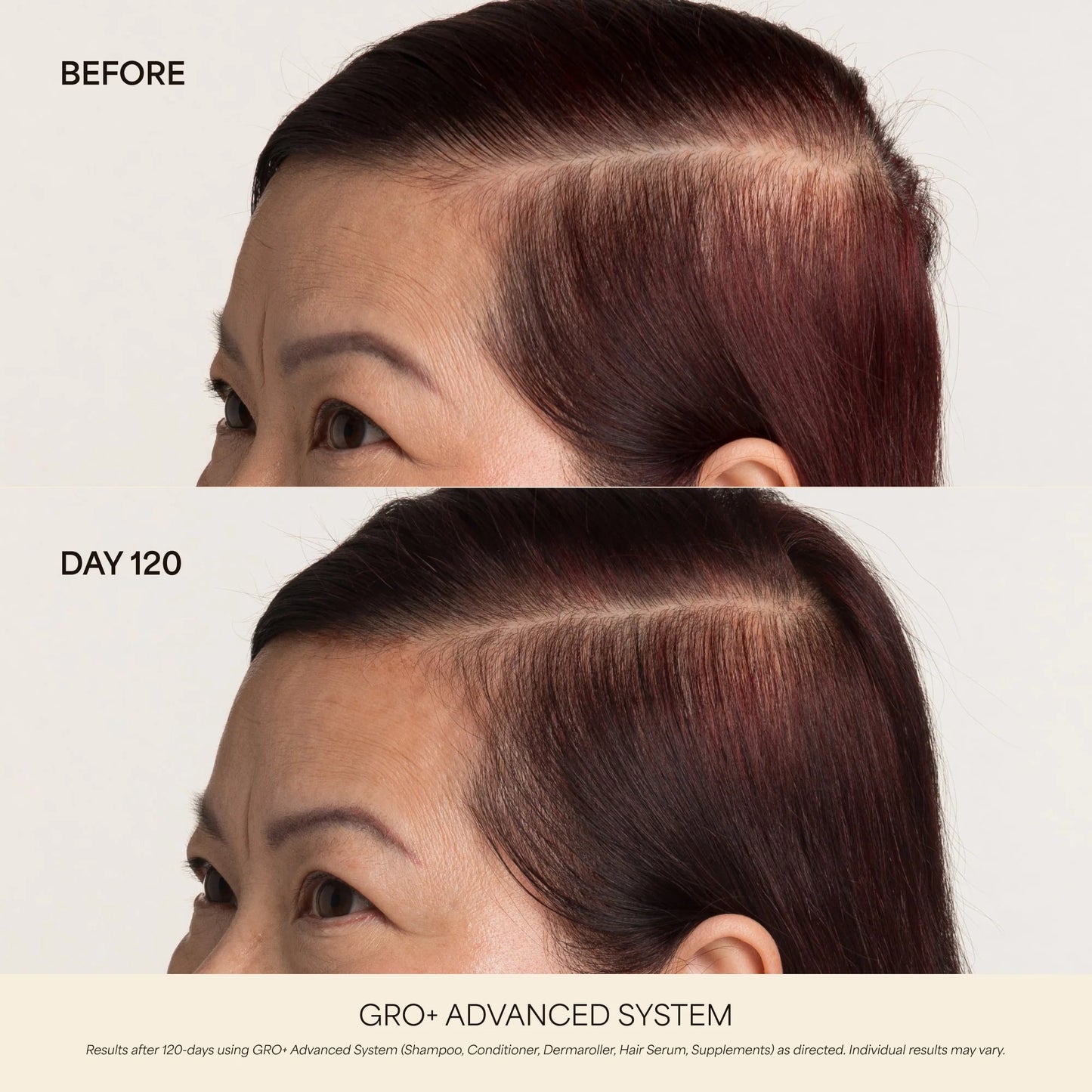 GRO+ Advanced Hair Growth & Density Supplements