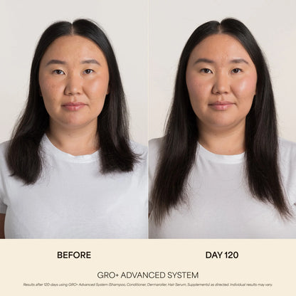 GRO+ Advanced Hair Growth & Density Supplements