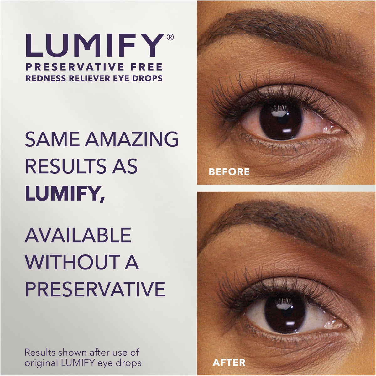 Lumify Redness Relief Eye Drops, Whiter & Brighter Looking Eyes, 0.25 oz